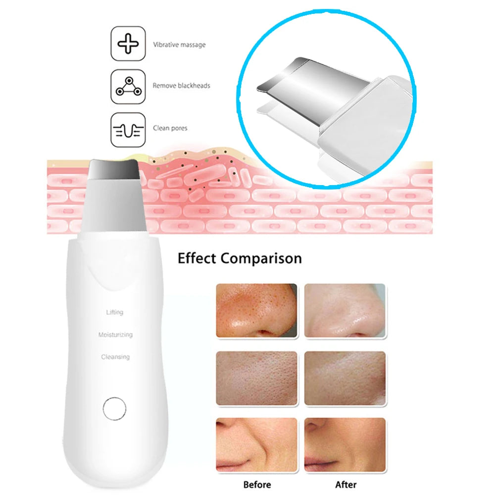 Ultraschall Gesichtsreiniger – Tiefenreinigung, Peeling & Mitesserentferner | Hautstraffung, Anti-Aging, Ionen-Technologie, Vibration | Professioneller Skin Scrubber für klare & glatte Haut
