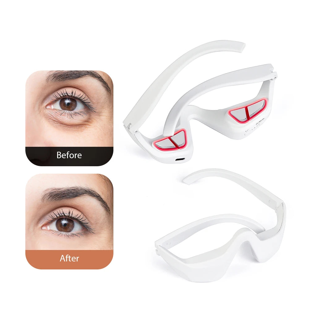 3D Augenmassagegerät mit EMS & Rotlicht – Elektrischer Eye Beauty Massager gegen Augenringe, Falten & Müdigkeit, Tragbares Augenpflege-Gerät
